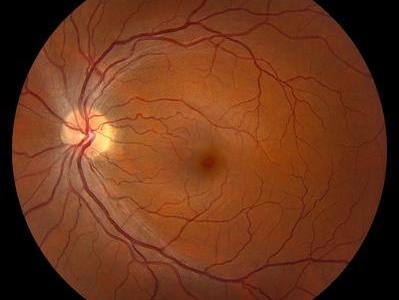 Retinal Health Evaluations